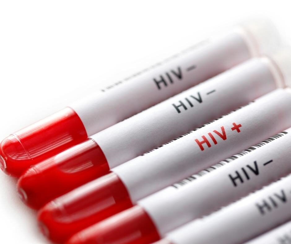 HIV Test Results