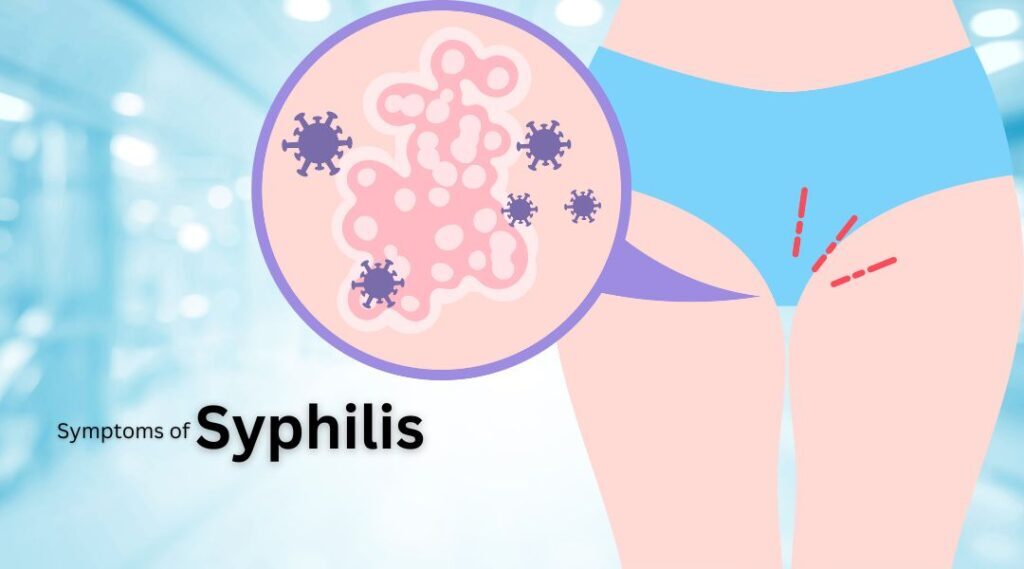 Syphilis: Causes, Symptoms, Diagnosis, and Treatment Options