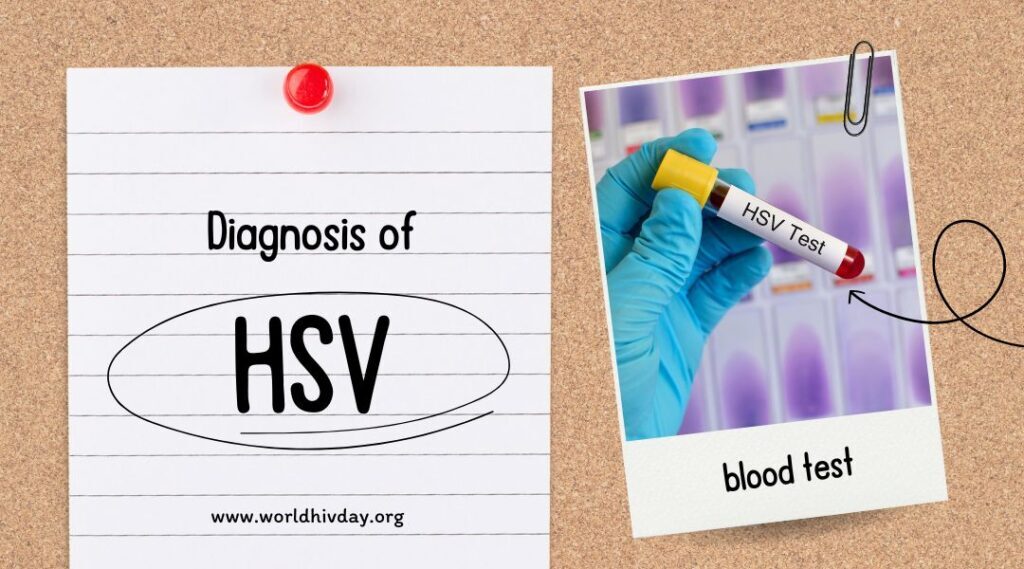 HSV | The illness that remains untreated