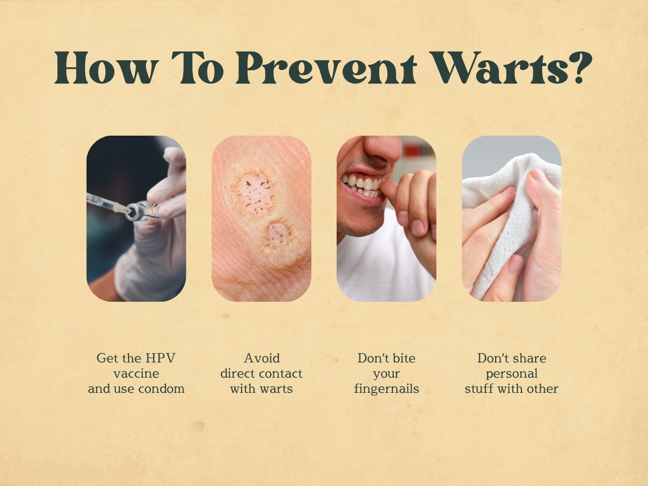 What are warts? World HIV Day