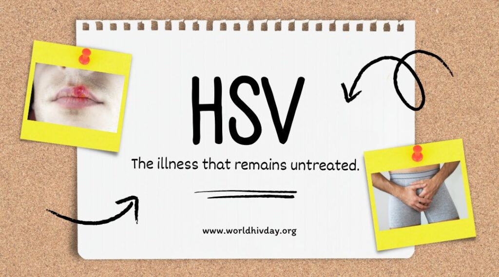 HSV The illness that remains untreated.